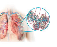 TYVASO® (treprostinil) Mechanism of Action